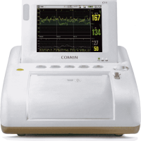 Fetal Monitor